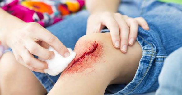 Cara Membersihkan Najis Darah